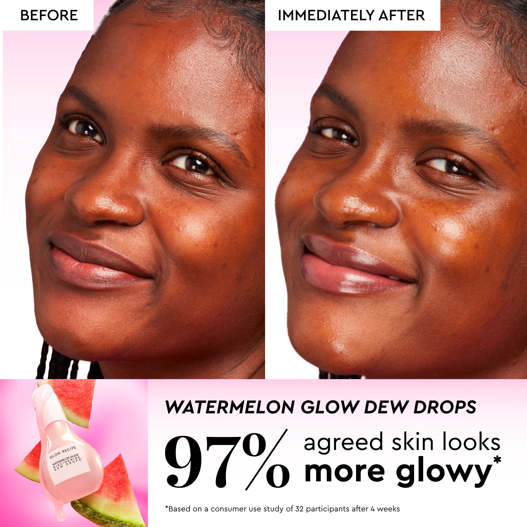 Watermelon Glow Best-Sellers Kit - Image 9