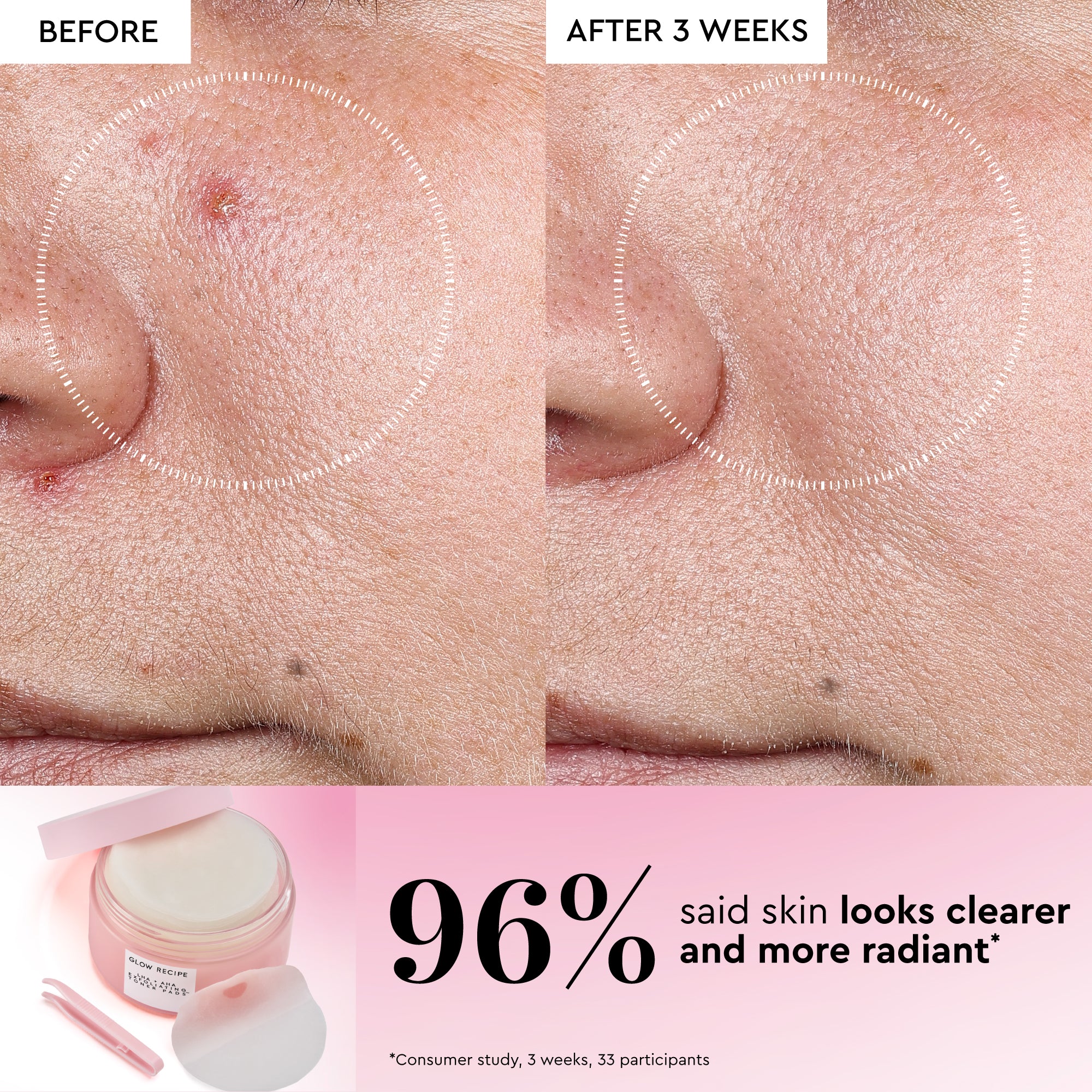 LHA + AHA Korean Watermelon Toner Pads - Image 3